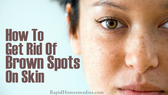 Discolored Skin Patches : 38 Causes, Photos & Treatments