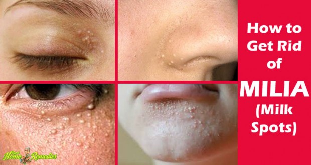 To Fat Pimples Of How Get Rid To Fat Pimples Of How Get Rid