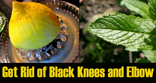 How to Get Rid of Black Knees and Elbow