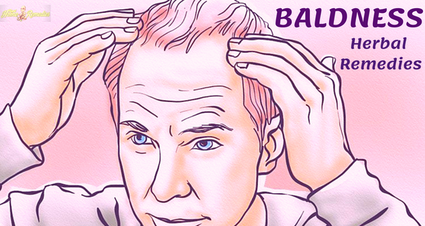 8 Top Home Herbal Remedies for Baldness