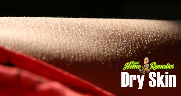 7 Best Natural Remedies for Dry Skin