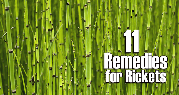 Top 11 Home Remedies for Rickets