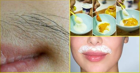 16 Amazing Home Remedies for Unwanted Hair Removal