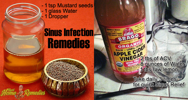 Remedies for Sinus Infection