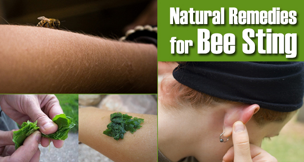 Remedies for Bee Sting