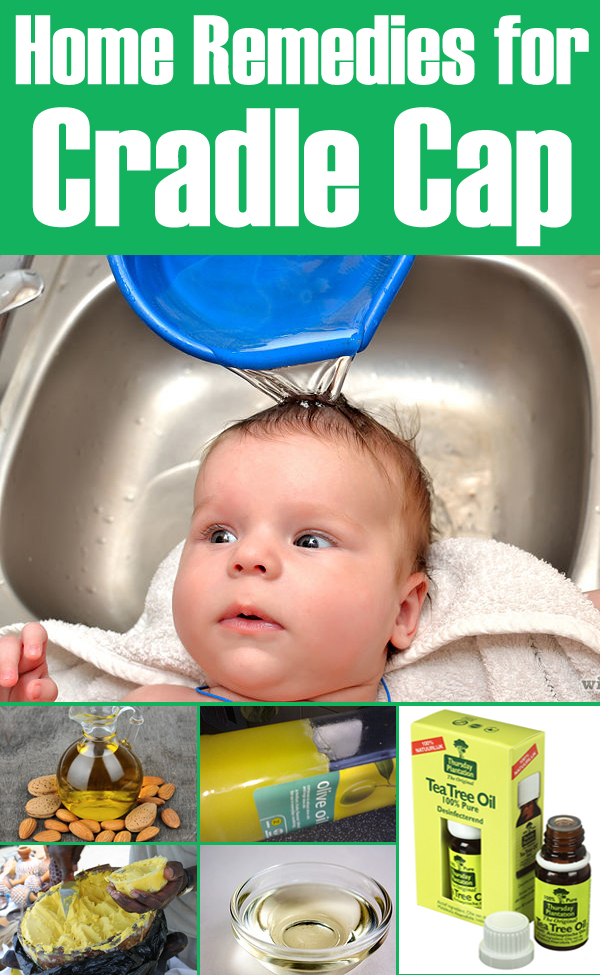 Cradle cap remedies
