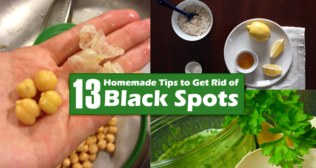 Get Rid of Black Spots