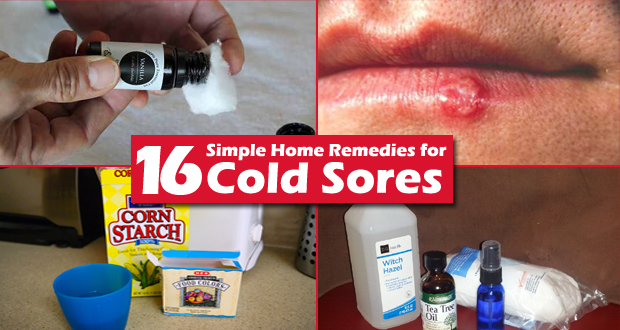 16 Simple Home Remedies for Cold Sores