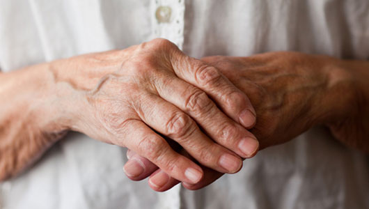 Remedies for Arthritis in Hands