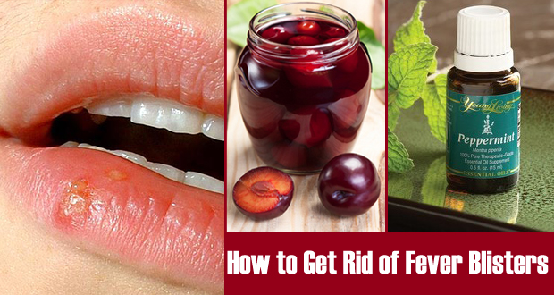 How to Get Rid of Fever Blisters