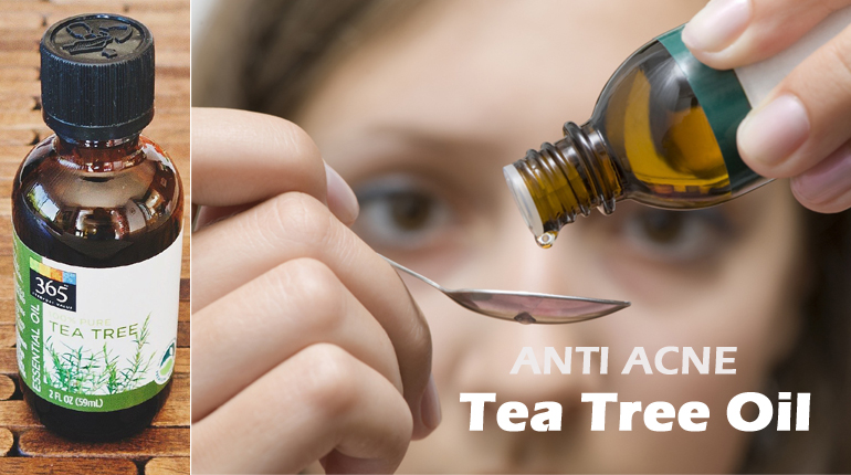 Tea Tree Oil for Acne