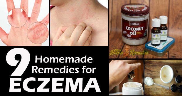 how to get rid of dermatofibroma at home