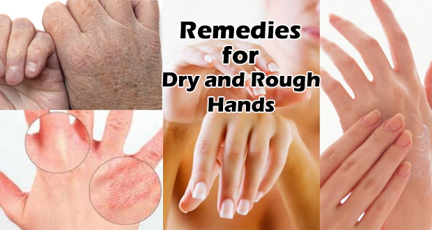 Dry and Rough Hands