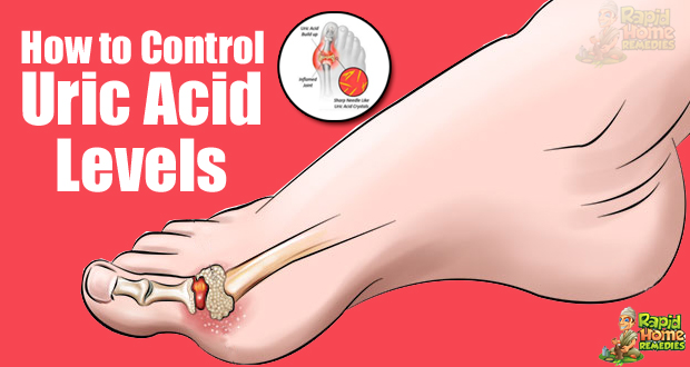 How to Control Uric Acid Levels