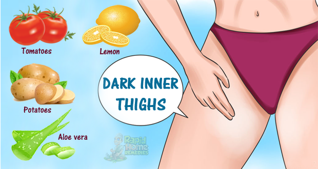 7 Tips to Lighten Your Dark Inner Thighs at Home