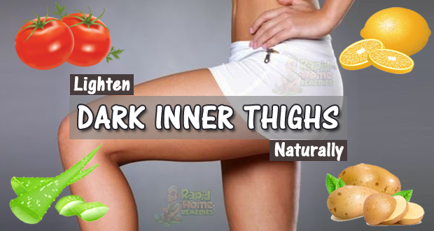 7 Tips to Lighten Your Dark Inner Thighs at Home