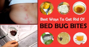 Natural Ways To Get Rid Of Mange In Dogs Natural Ways To Get Rid Of Mange In Dogs