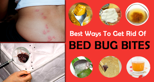 Get Rid of Bed Bug Bites