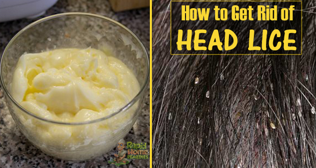 How to Get Rid of Head Lice