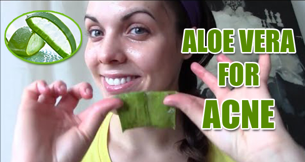 9 Simple Ways to Use Aloe Vera for Acne